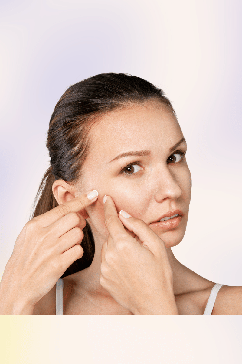 Face Wash A Miracle for Hormonal Acne & SelfEsteem!