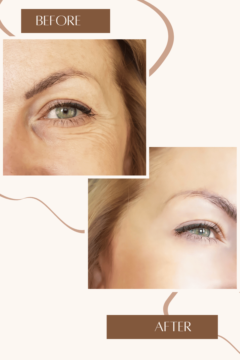 5 Premium Firming Eye Creams: A Magic Potion for Wrinkles!